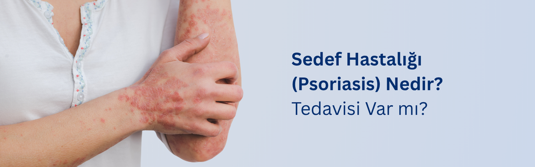 Sedef Hastalığı (Psoriasis) Nedir? Tedavisi var mı?