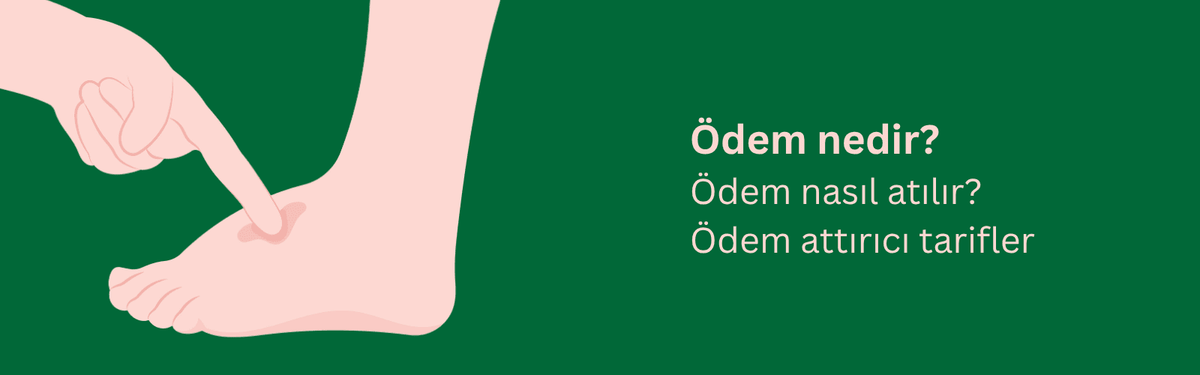Ödem Nedir, Neden Olur ve Nasıl Atılır?