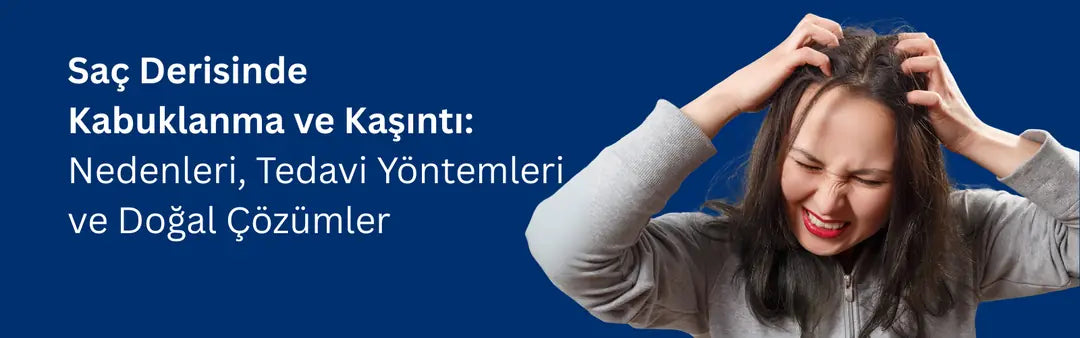 Saç Derisinde Kabuklanma ve Kaşıntı: Nedenleri, Tedavi Yöntemleri ve Doğal Çözümler