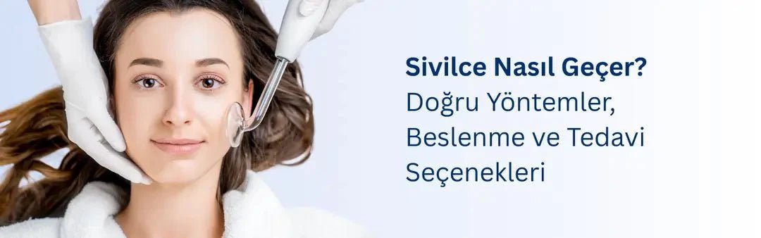 Sivilce Nasıl Geçer? Beslenme ve Tedavi Seçenekleri