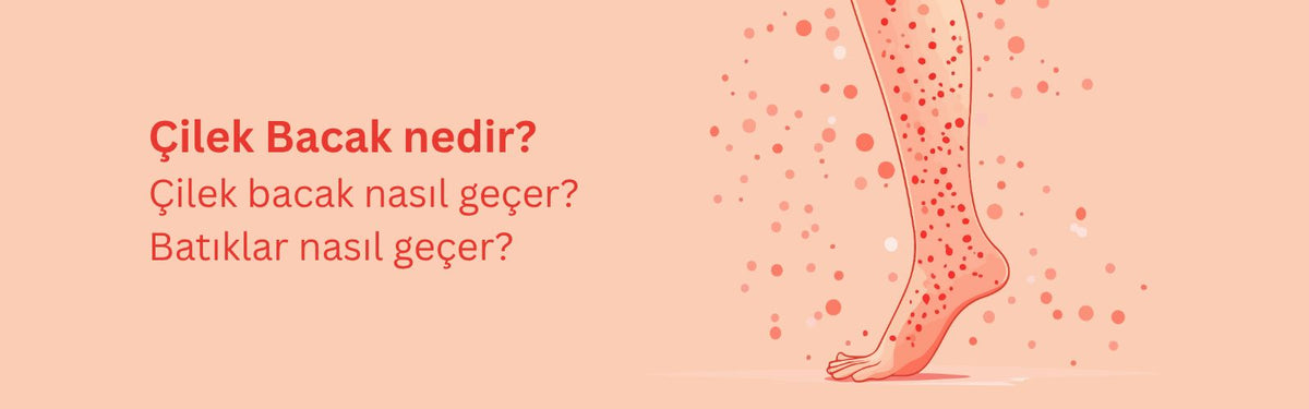 Çilek Bacak Nasıl Geçer? Batıklar Nasıl Geçer?