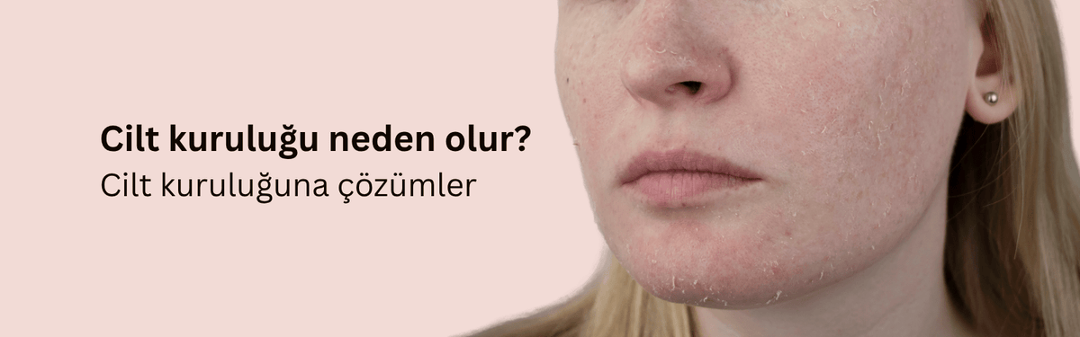 Kuru Cilt Neden Olur? Belirtileri ve Nedenleri