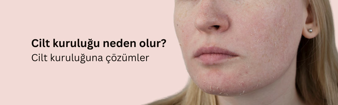 Kuru Cilt Nedir? Cilt Kuruluğu Neden Olur? Cilt Kuruluğuna Ne İyi Gelir?