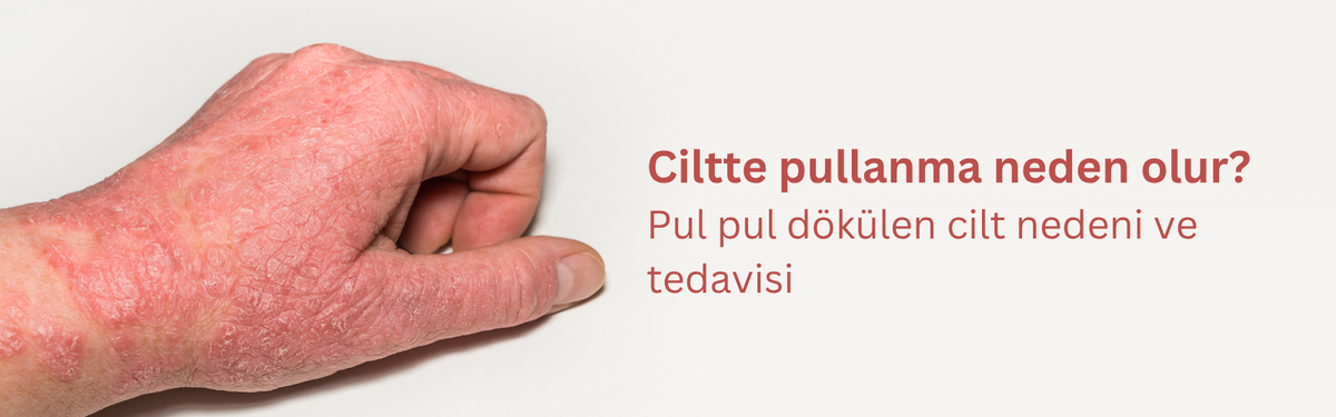 Ciltte Kuruluk, Pullanma ve Dökülme Neden Olur? Yağlı ve Kuru Pullanma